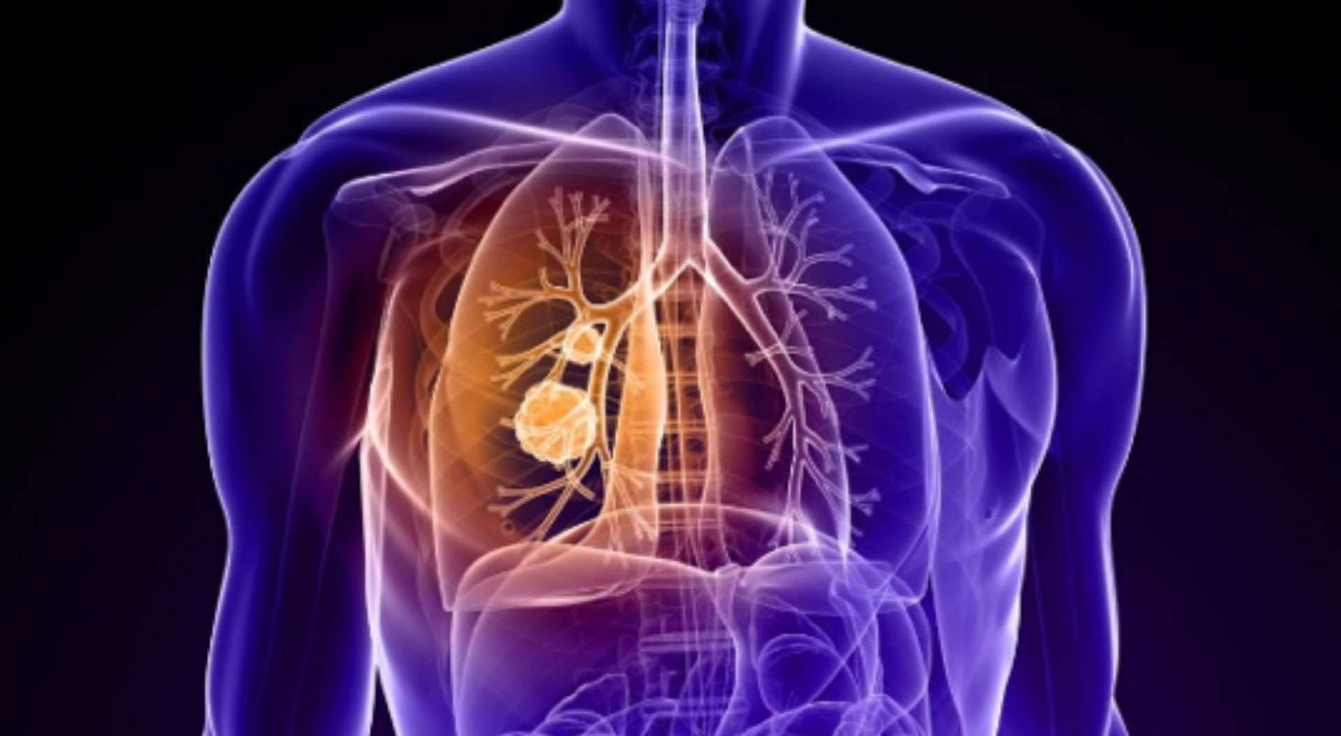What does Your Business do with a Medical Breakthrough?